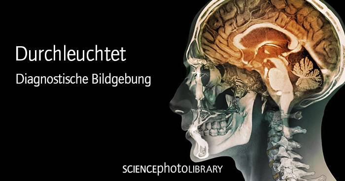 Durchleuchtet – Diagnostische Bildgebung