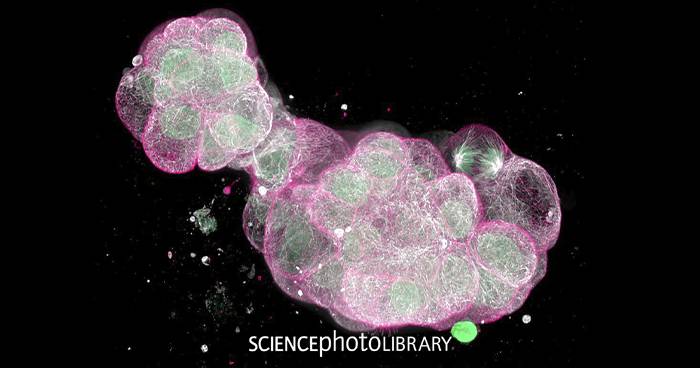 Darmkrebsmonat März: Vorsorge kann Leben retten