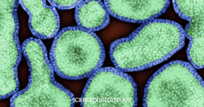 Infektionen durch Viren und Bakterien